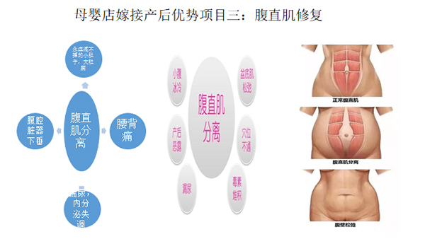 少林永化堂產(chǎn)后項目-腹直肌修復(fù).jpg 少林永化堂產(chǎn)后項目-腹直肌修復(fù).jpg