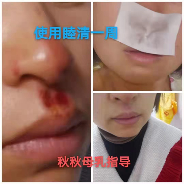 �����澏���N���Æ������M�߿ڱ������������a(ch��n)ƷȦ�۟o��(sh��)